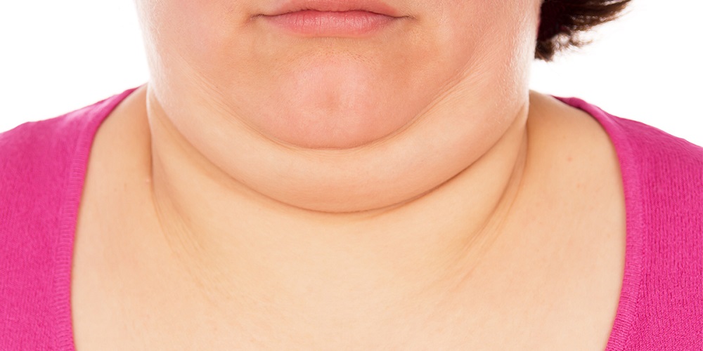 از بین بردن غبغب با چند حرکت ساده - ایران فیتنس از بین بردن غبغب با چند حرکت ساده