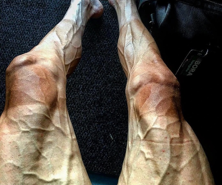 برجستگی رگ های بدن نشانه چیست؟ | علت دیده شدن رگ ها