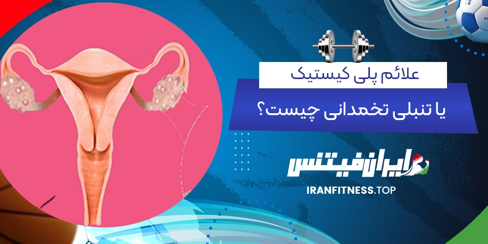 علائم پلی کیستیک یا تنبلی تخمدانی چیست؟ - ایران فیتنس علائم پلی کیستیک یا تنبلی تخمدانی چیست؟