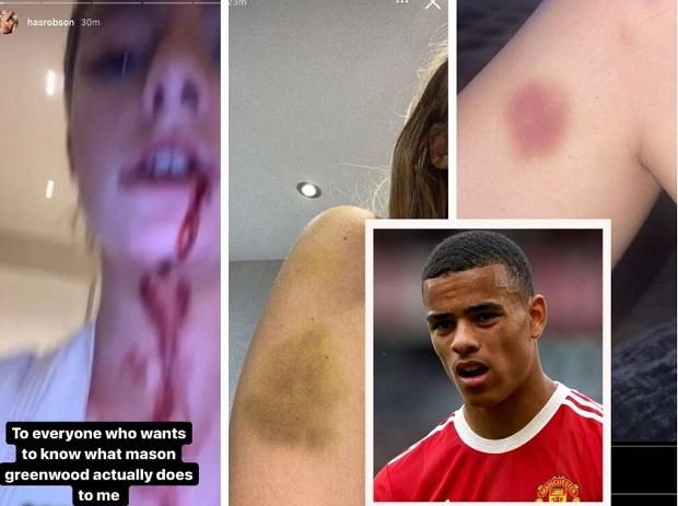 حبس میسن گرینوود - فیتنس حبس میسن گرینوود